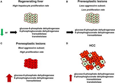 Emerging Role of the Pentose Phosphate Pathway in Hepatocellular Carcinoma